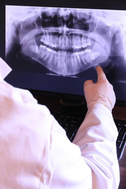 Best Root Canal Emergency Dentist  in Clinton, MD